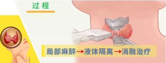 5d6e4f48b6b64709adbf42538e87680f.png image.png